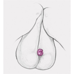 GRING XL SWEET RASPBERRY